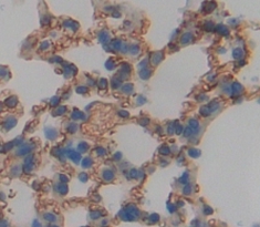 Polyclonal Antibody to Cluster Of Differentiation 64 (CD64)