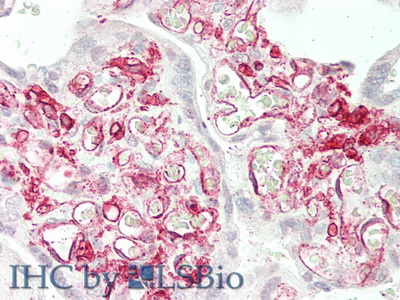 Polyclonal Antibody to Cluster Of Differentiation 32 (CD32)