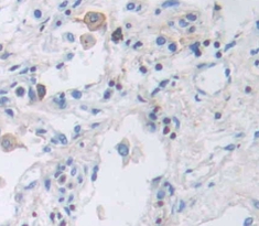 Polyclonal Antibody to Integrin Beta 2 (CD18)