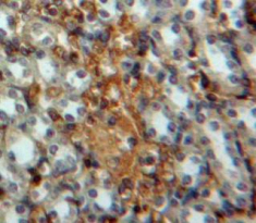 Polyclonal Antibody to Interferon Regulatory Factor 3 (IRF3)