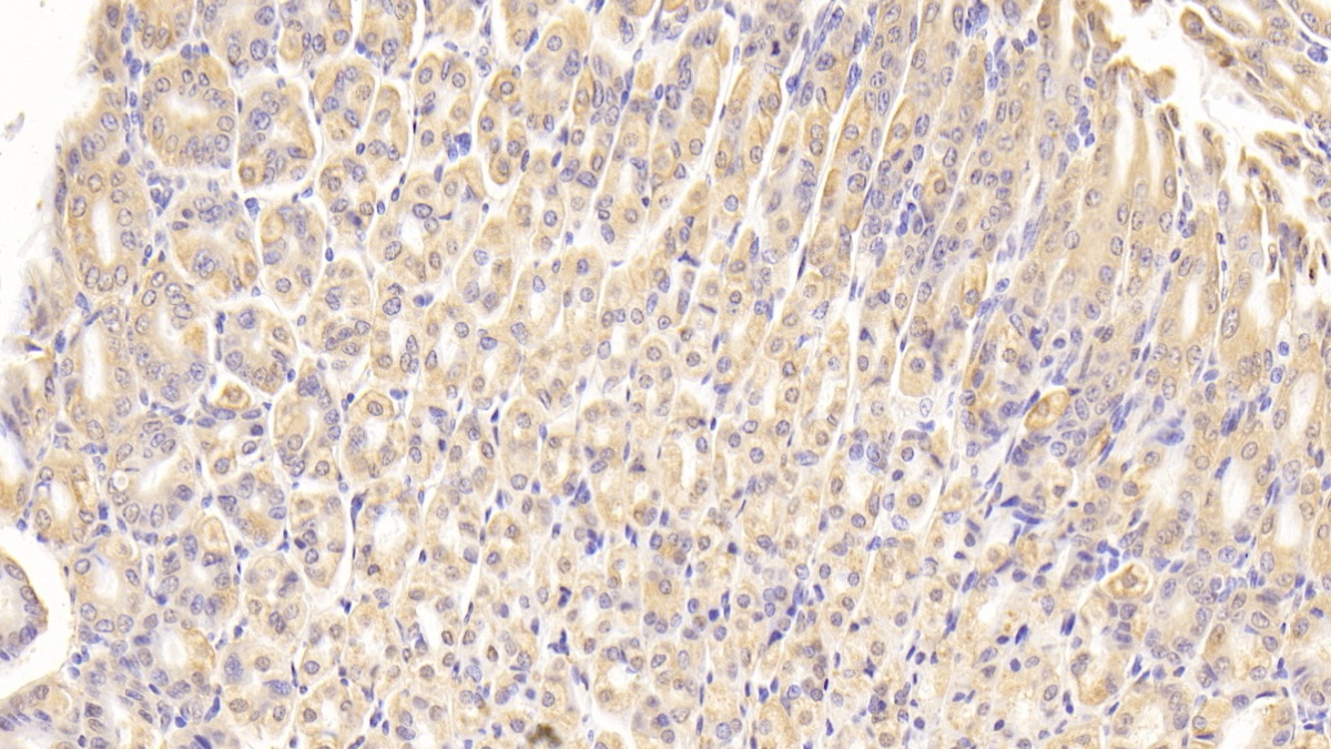 Polyclonal Antibody to Interferon Regulatory Factor 3 (IRF3)