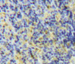 Polyclonal Antibody to Lymphocyte Antigen 75 (LY75)