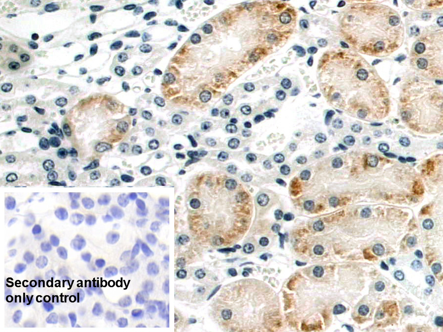 Polyclonal Antibody to Cluster Of Differentiation 164 (CD164)