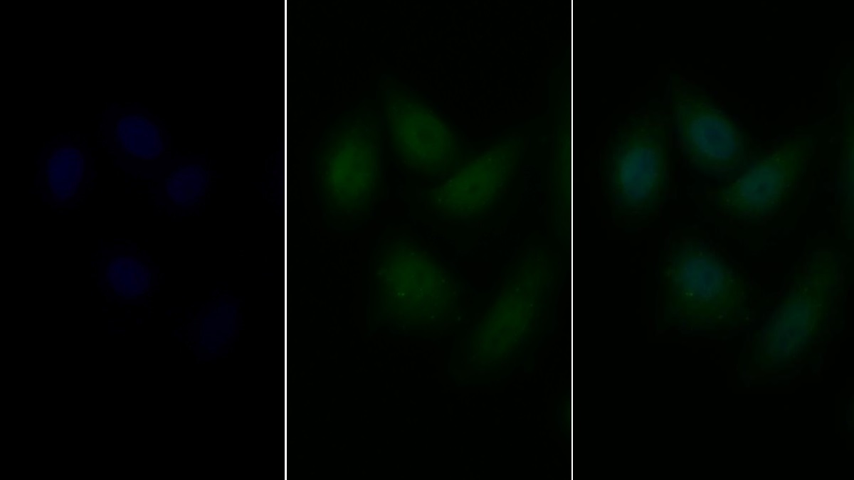 Polyclonal Antibody to Interferon Regulatory Factor 5 (IRF5)