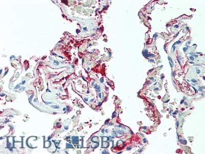 Polyclonal Antibody to Chemokine (C-X-C Motif) Ligand 2 (CXCL2)