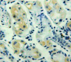 Polyclonal Antibody to Chemokine (C-X-C Motif) Ligand 3 (CXCL3)