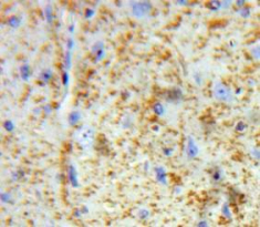 Polyclonal Antibody to Chemokine (C-X-C Motif) Ligand 14 (CXCL14)