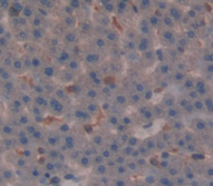 Polyclonal Antibody to Glucocorticoid Receptor (GR)