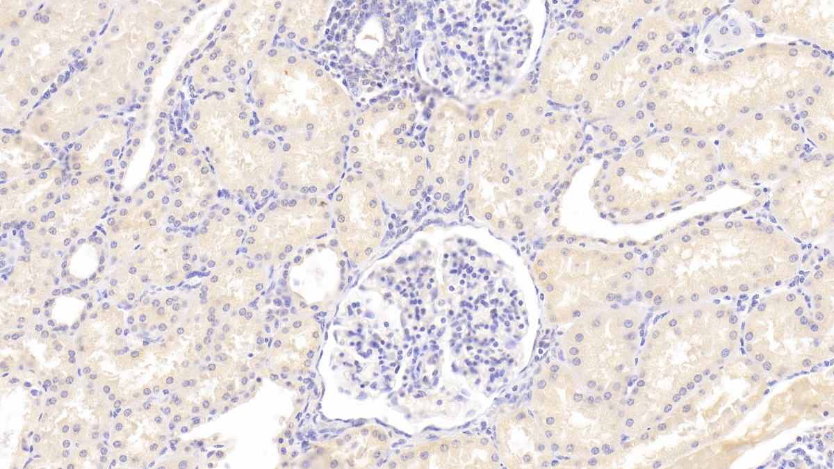 Polyclonal Antibody to Lysosomal Associated Membrane Protein 3 (LAMP3)