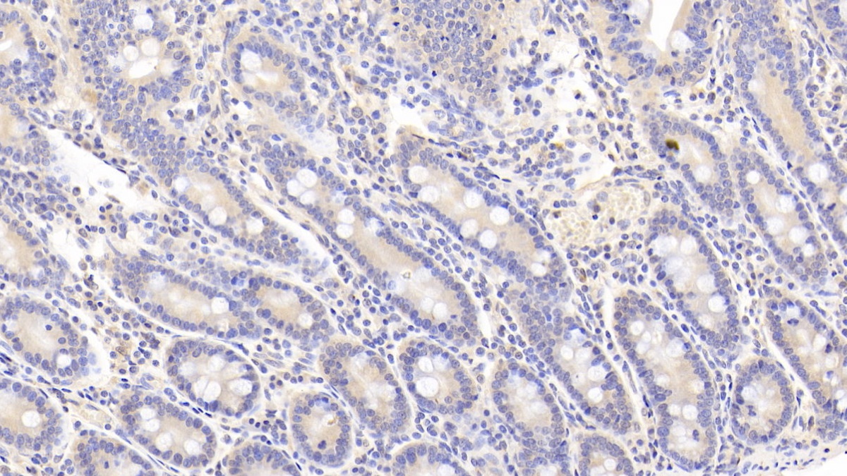 Polyclonal Antibody to Neuraminidase (NEU)