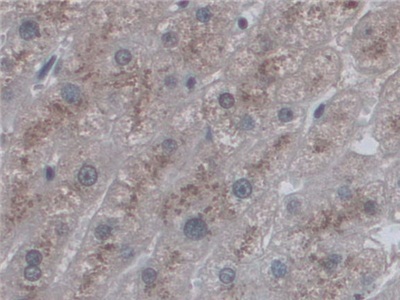 Polyclonal Antibody to Cluster Of Differentiation 209 (CD209)