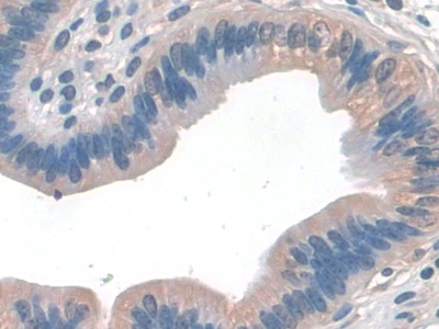 Polyclonal Antibody to Cluster Of Differentiation 209 (CD209)