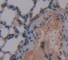 Polyclonal Antibody to Surfactant Protein C (SP-C)