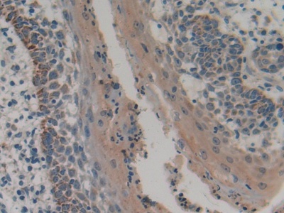 Polyclonal Antibody to Cytosolic Phospholipase A2 (PLA2G4)