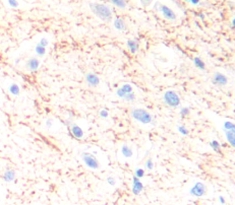 Polyclonal Antibody to Dopamine Transporter (DAT)