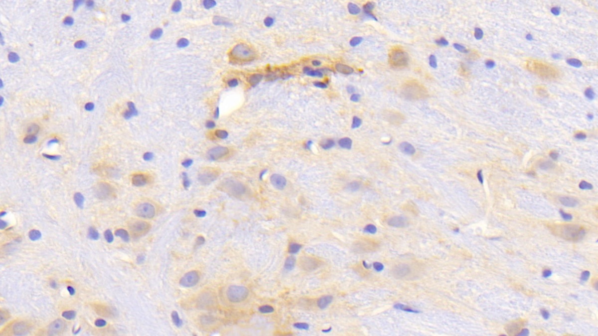 Polyclonal Antibody to Dopamine Transporter (DAT)