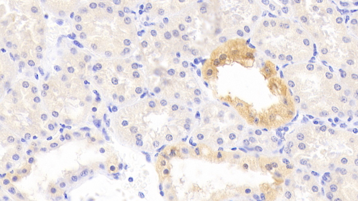 Polyclonal Antibody to Potassium Chloride Cotransporters 3 (KCC3)