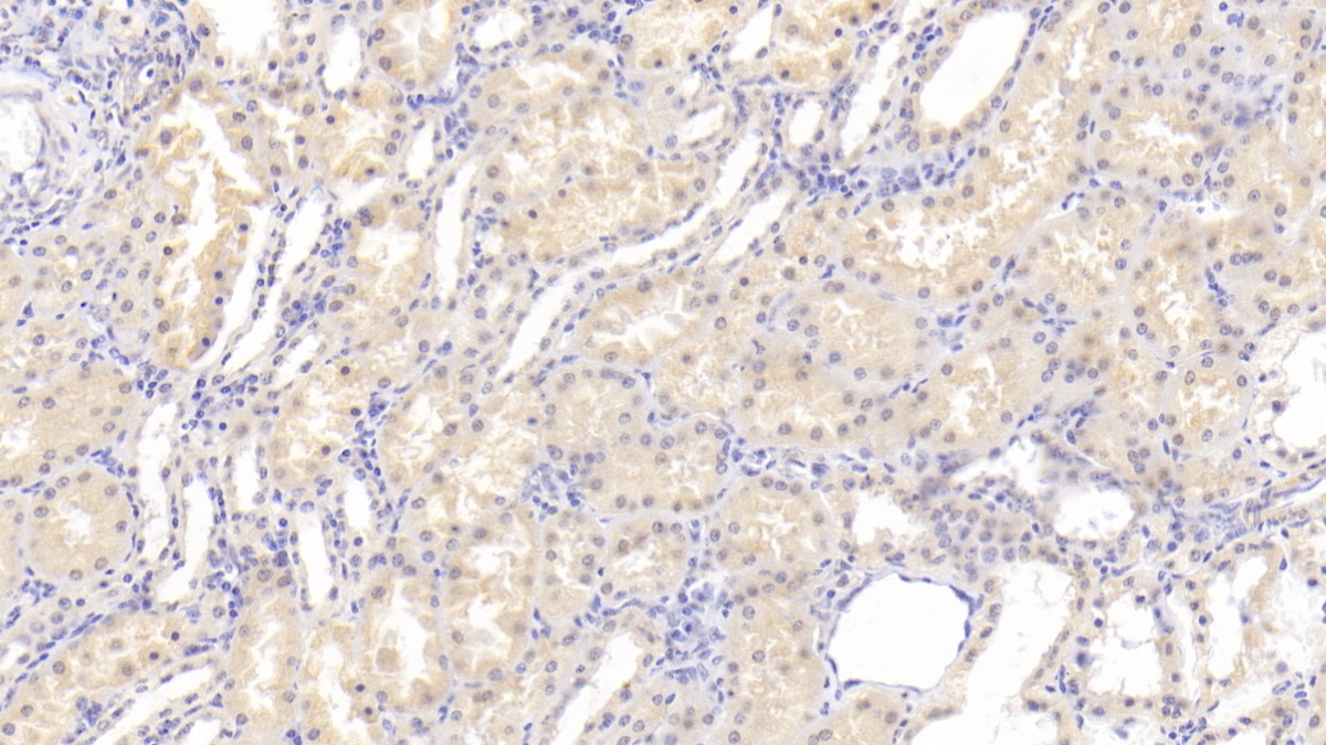 Polyclonal Antibody to Peptidylprolyl Isomerase C (PPIC)