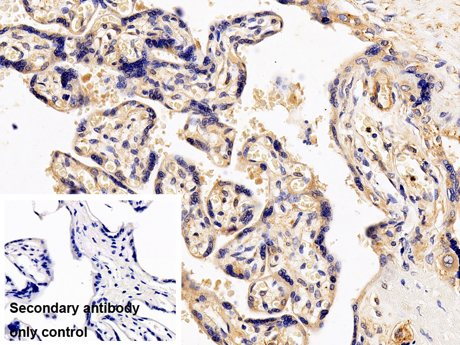 Polyclonal Antibody to Interleukin 13 Receptor Alpha 1 (IL13Ra1)