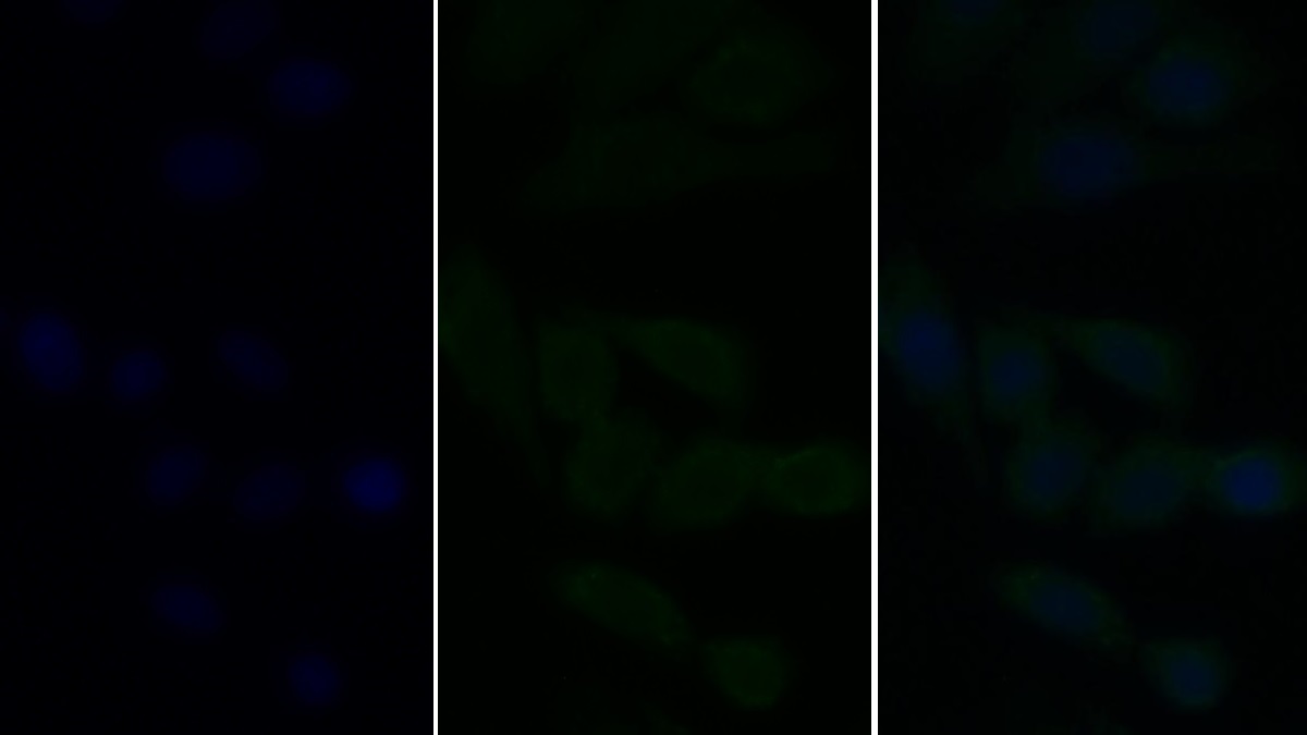 Polyclonal Antibody to Interleukin 13 Receptor Alpha 1 (IL13Ra1)