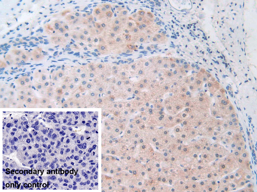 Polyclonal Antibody to Electron Transfer Flavoprotein Beta Polypeptide (ETFb)