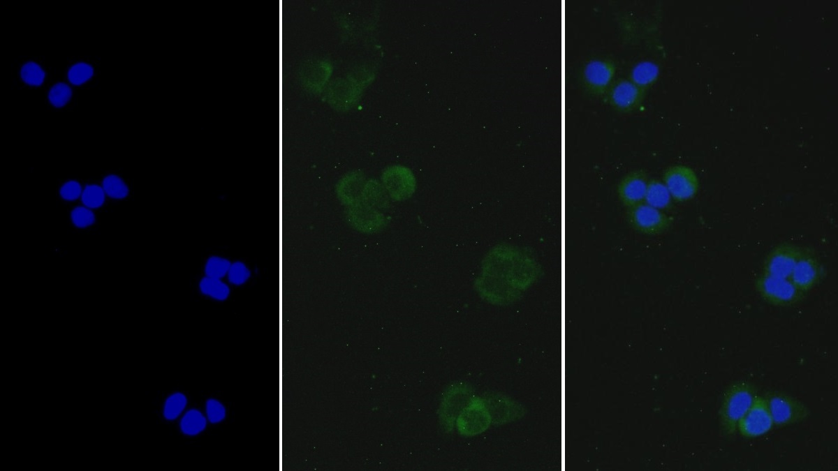 Polyclonal Antibody to Interleukin 13 Receptor Alpha 2 (IL13Ra2)