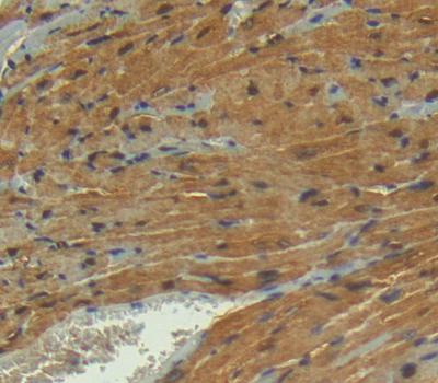 Polyclonal Antibody to Phosphoglycerate Mutase 2, Muscle (PGAM2)