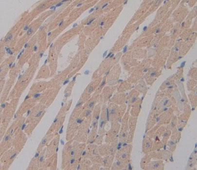 Polyclonal Antibody to Phosphoglycerate Mutase 2, Muscle (PGAM2)