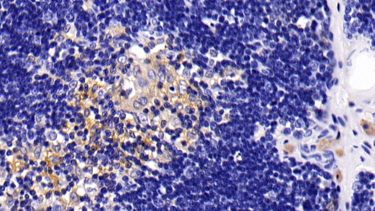 Polyclonal Antibody to Chemokine C-C-Motif Receptor 7 (CCR7)