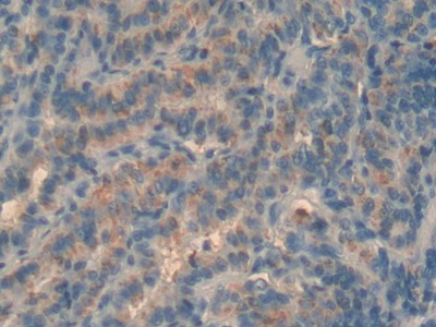 Polyclonal Antibody to Major Basic Protein (MBP)