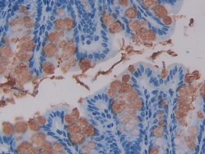 Polyclonal Antibody to Trefoil Factor 3 (TFF3)