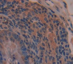 Polyclonal Antibody to Trefoil Factor 3 (TFF3)