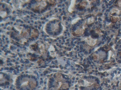 Polyclonal Antibody to Trefoil Factor 3 (TFF3)