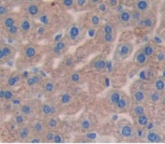 Polyclonal Antibody to Solute Carrier Family 27 Member 5 (SLC27A5)