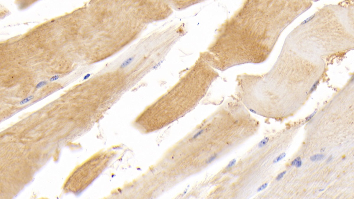 Polyclonal Antibody to Titin (TTN)