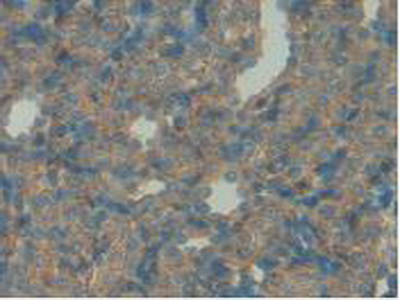 Polyclonal Antibody to Insulin Like Growth Factor Binding Protein 7 (IGFBP7)