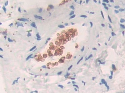 Polyclonal Antibody to Band 3 (BND3)