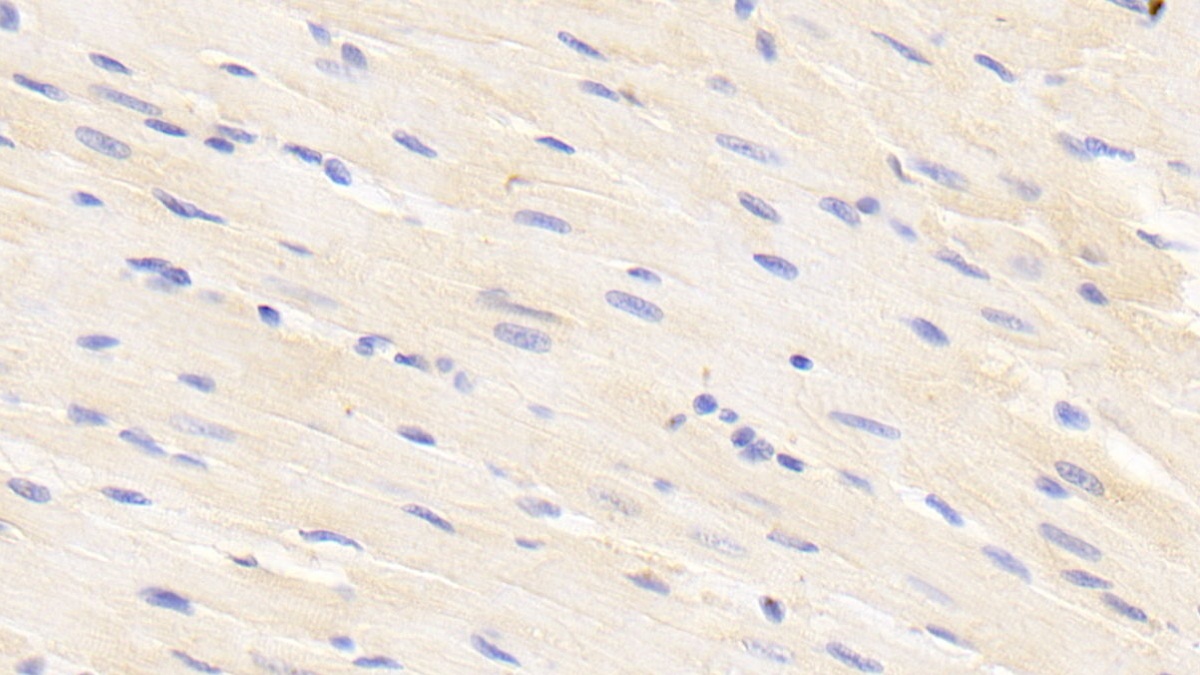 Polyclonal Antibody to Suppressors Of Cytokine Signaling 3 (SOCS3)