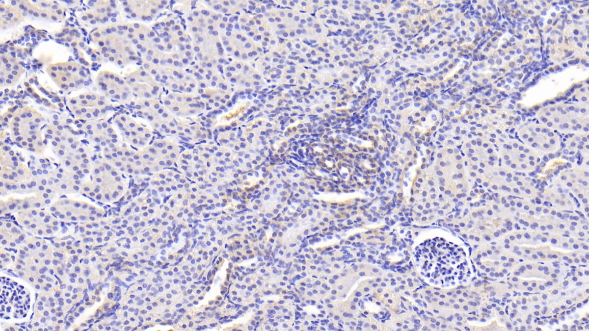 Polyclonal Antibody to Permeability Glycoprotein (Pgp)