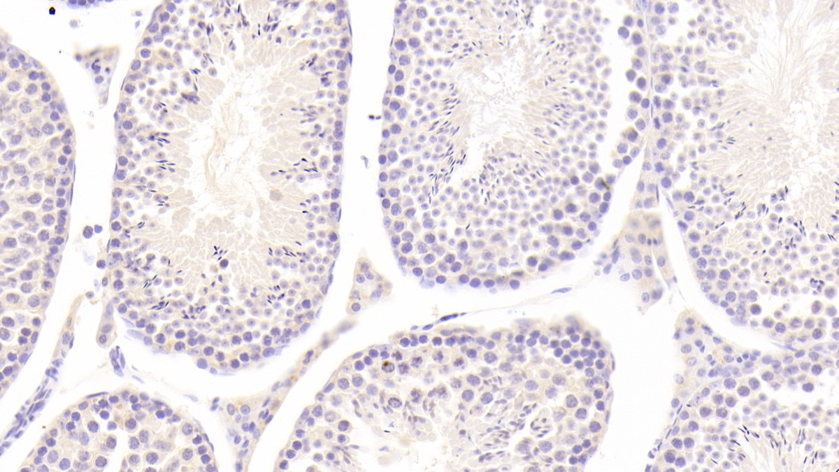 Polyclonal Antibody to Interleukin 25 (IL25)