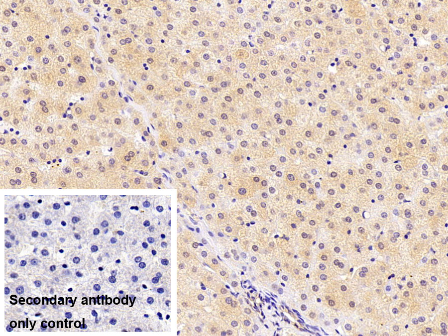 Polyclonal Antibody to Alpha-1-Antitrypsin (a1AT)