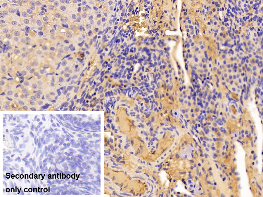 Polyclonal Antibody to Alpha-1-Antitrypsin (a1AT)