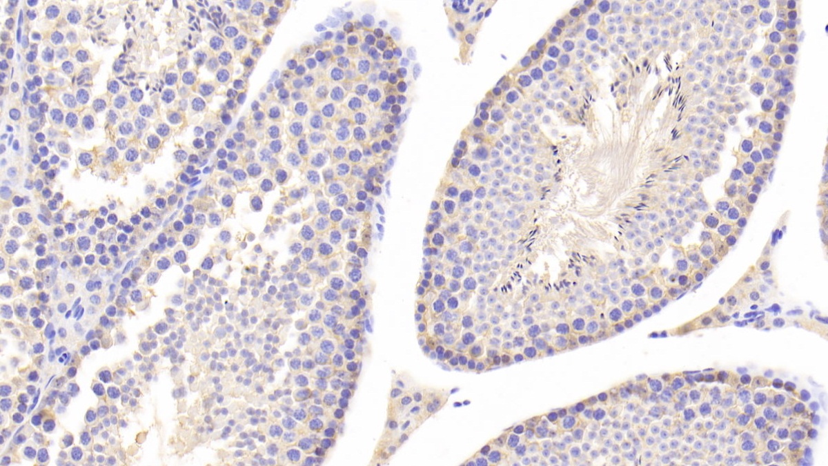 Polyclonal Antibody to Lactate Dehydrogenase B (LDHB)