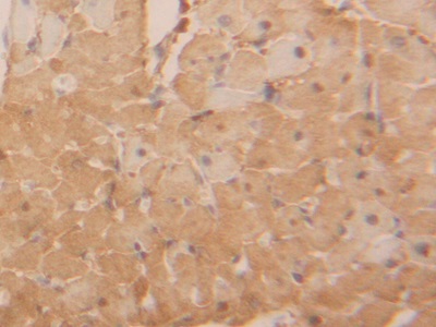 Polyclonal Antibody to Lactate Dehydrogenase B (LDHB)