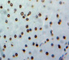 Polyclonal Antibody to TATA Binding Protein (TBP)