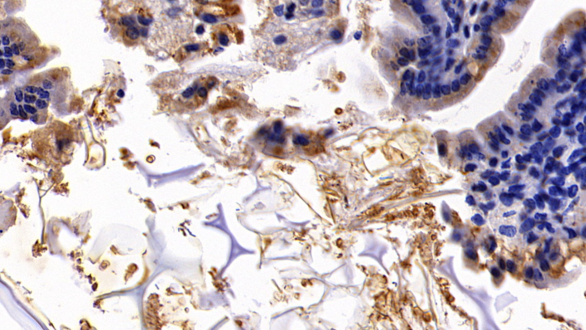 Polyclonal Antibody to Glycophorin A (GYPA)