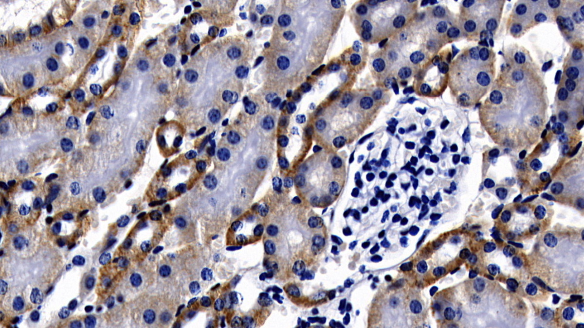 Polyclonal Antibody to Myeloid Differentiation Factor 88 (MyD88)