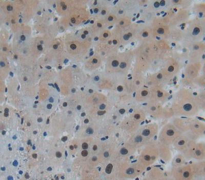 Polyclonal Antibody to Kruppel Like Factor 5, Intestinal (KLF5)