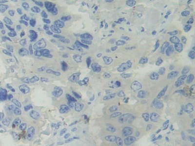 Polyclonal Antibody to Basal Cell Adhesion Molecule (BCAM)