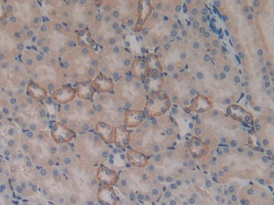 Polyclonal Antibody to Serum/Glucocorticoid Regulated Kinase 1 (SGK1)